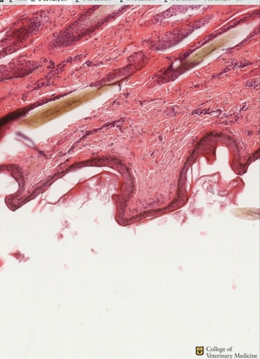 <p>What epithelium type is shown?</p>