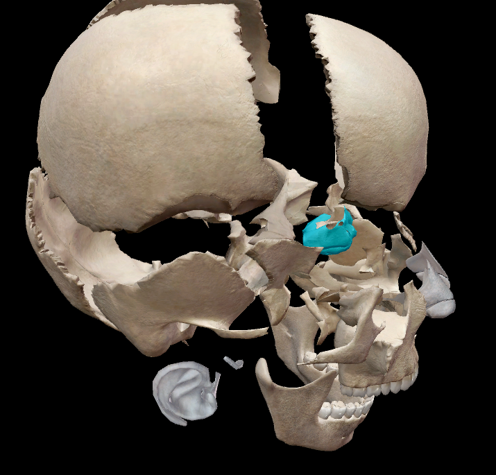term image