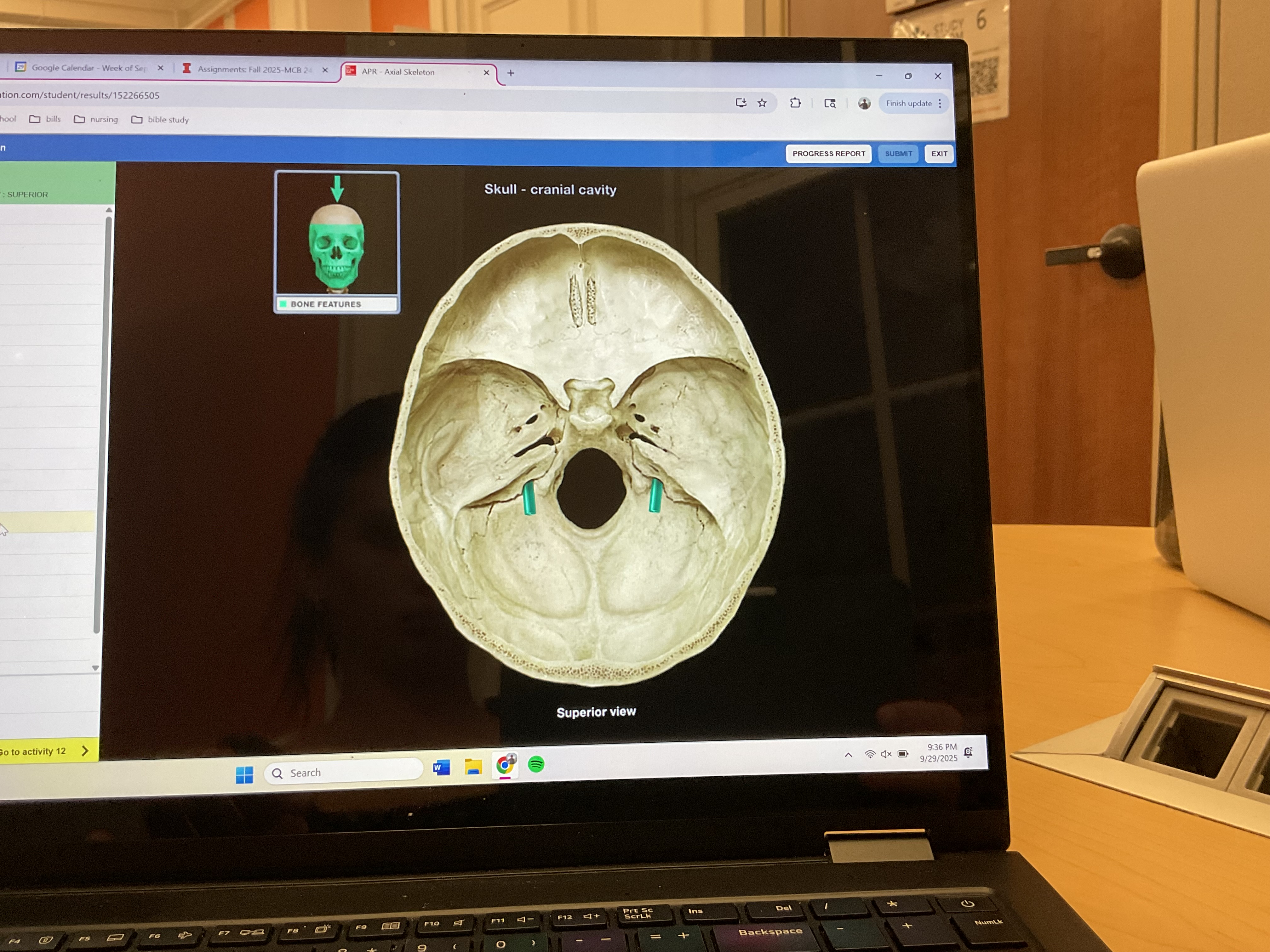 <p>Jugular Foramen </p>