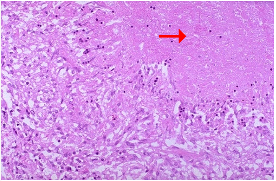 <ol><li><p>Identify cellular process</p></li><li><p>Identify pointer area</p></li></ol><p></p>