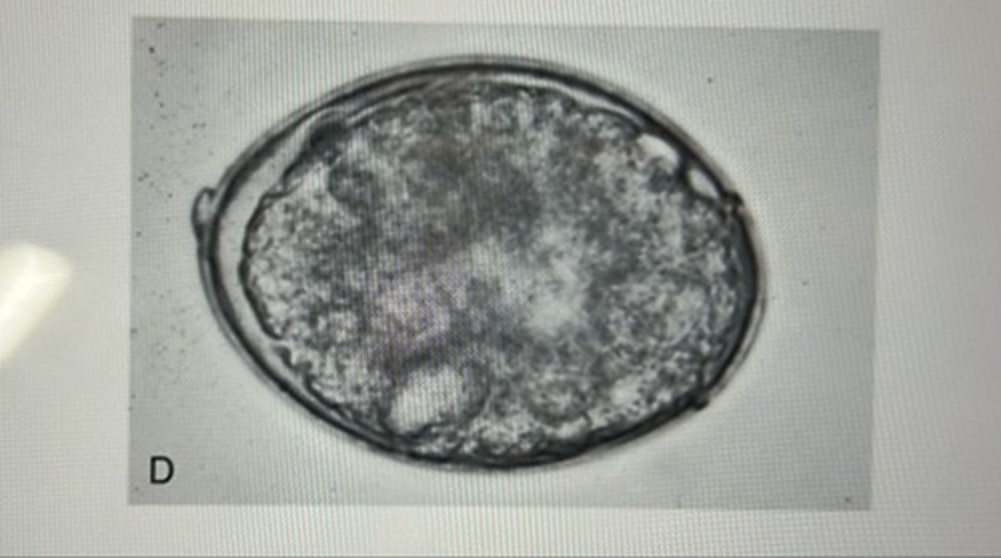 <p>This Cestode-type ovum has operculum with an oval shape. It contains a six-hooked hexacanth and can be confused with eggs of Ancylostoma species. This Cestode-type ova is called..</p>