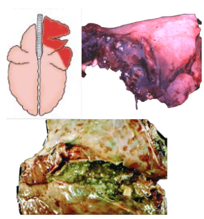 <p>What pattern of lung pathology? Describe it and pathogenesis. 4 example causes and 1 differential diagnosis. </p>