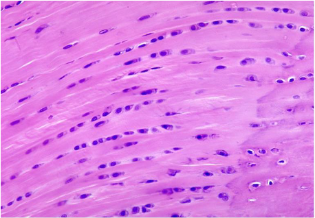 <p>Which cartilage is shown in the following image?</p>