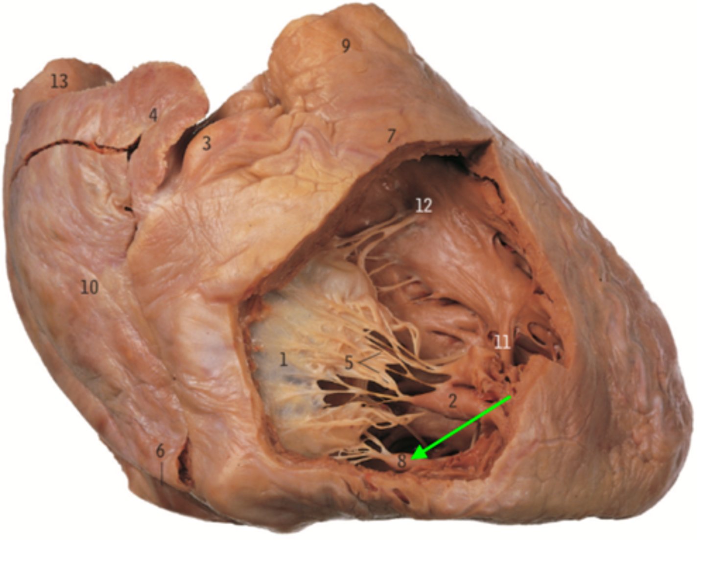 <p>Name the Muscle of the Right Ventricle</p>