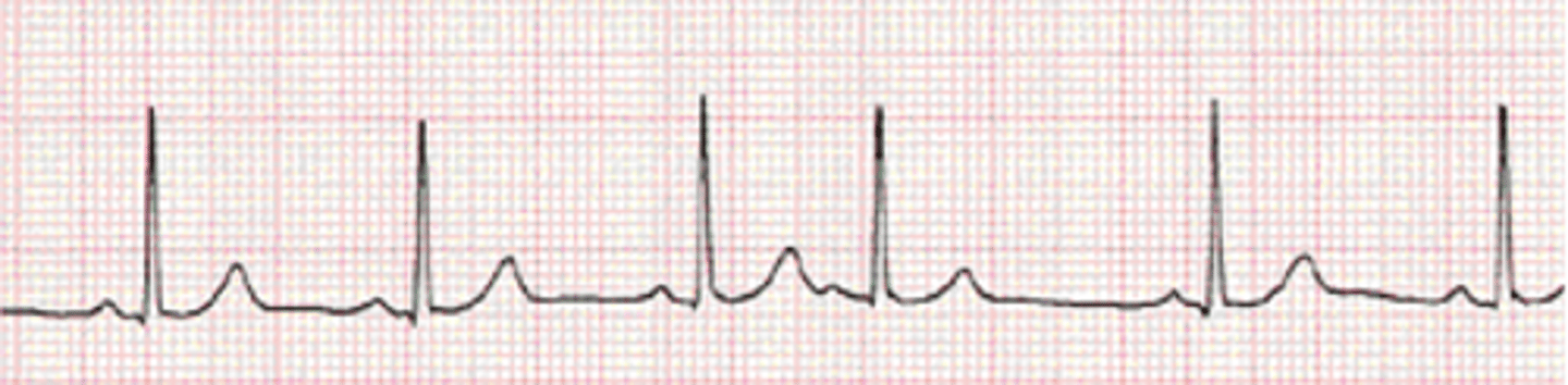 <p>Rhythm?</p><p>Management?</p>