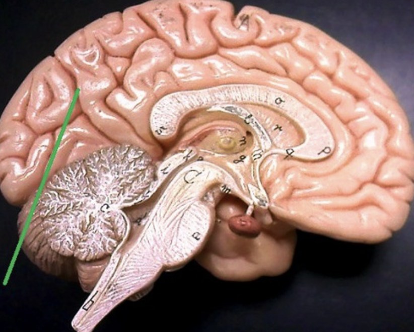 <p>only seen on medial side</p>