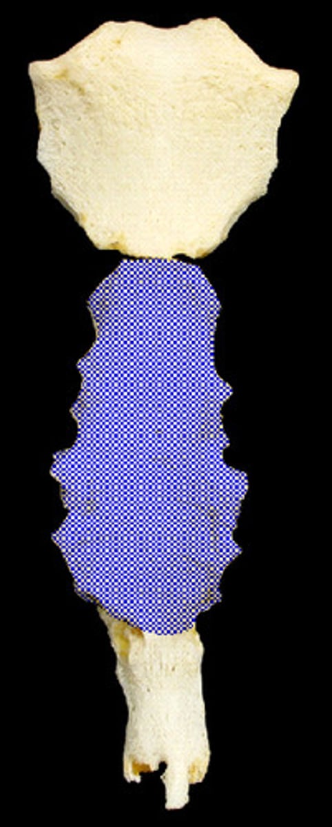 <p>the bony structure that forms the middle portion of the sternum</p>