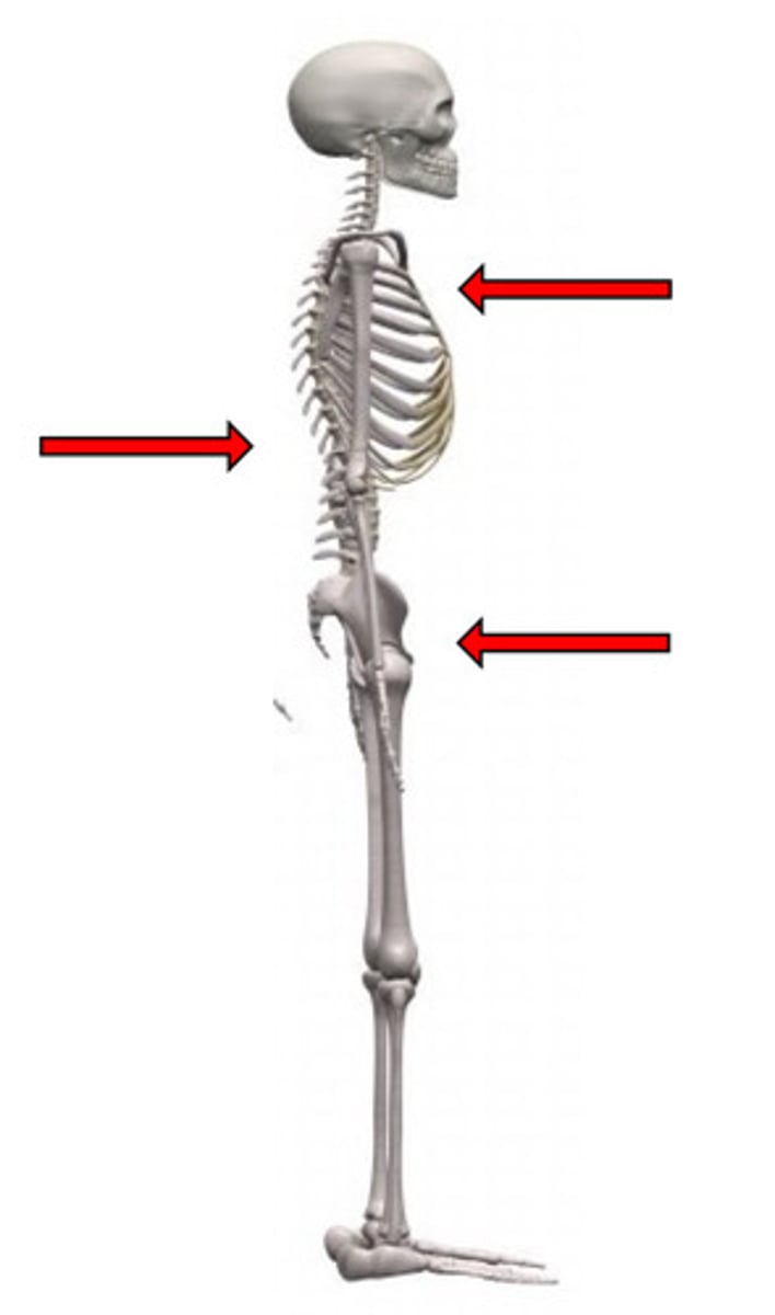 <p>1 anteriorly-directed corrective force</p><p>2 posteriorly-directed stabilizing forces (inferior and superior)</p>