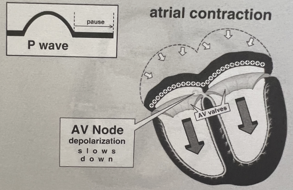 <p><span style="color: blue;"><strong>Atrial depolarization </strong></span></p>
