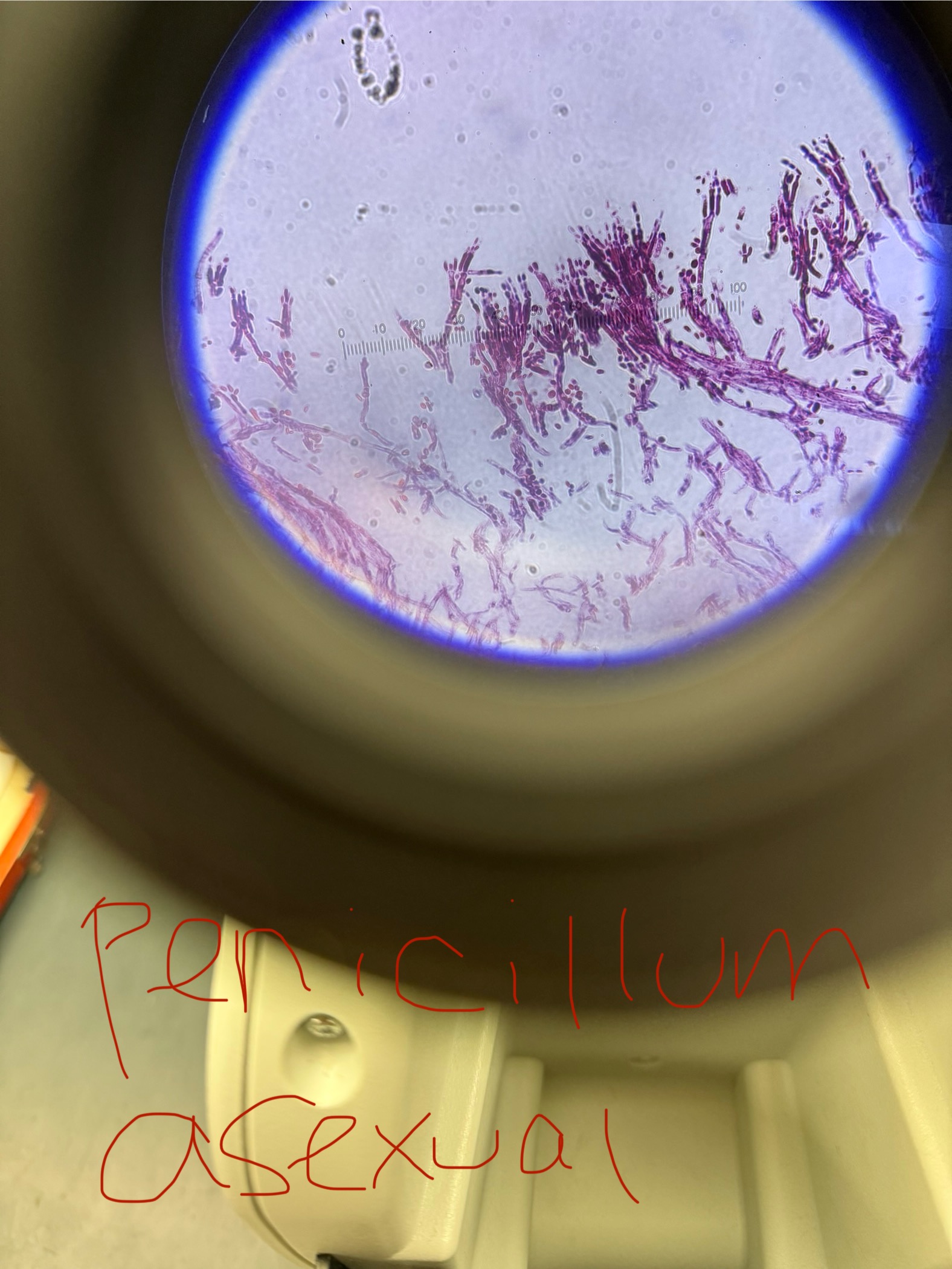 <p>Penicillium chrysogenum</p>