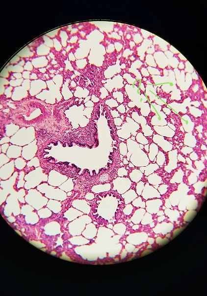 <p>what is outlined?</p>