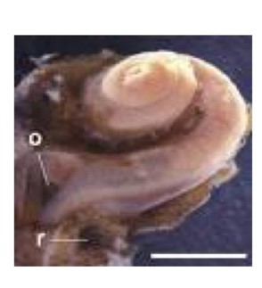 <p>A fluid filled space within the temporal bone that is responsible for hearing </p>