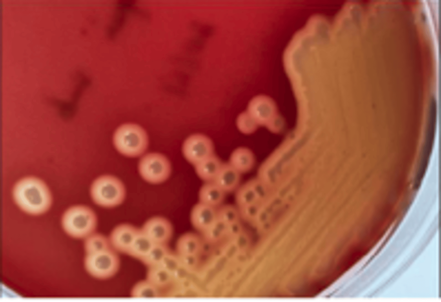 <p>This organism was isolated from a horse that developed a high fever and swollen submandibular</p><p>lymph nodes several days after returning from a two-day riding event. The organism grew on BA</p><p>but did not grow on MAC. What is your presumptive identification and why?</p>