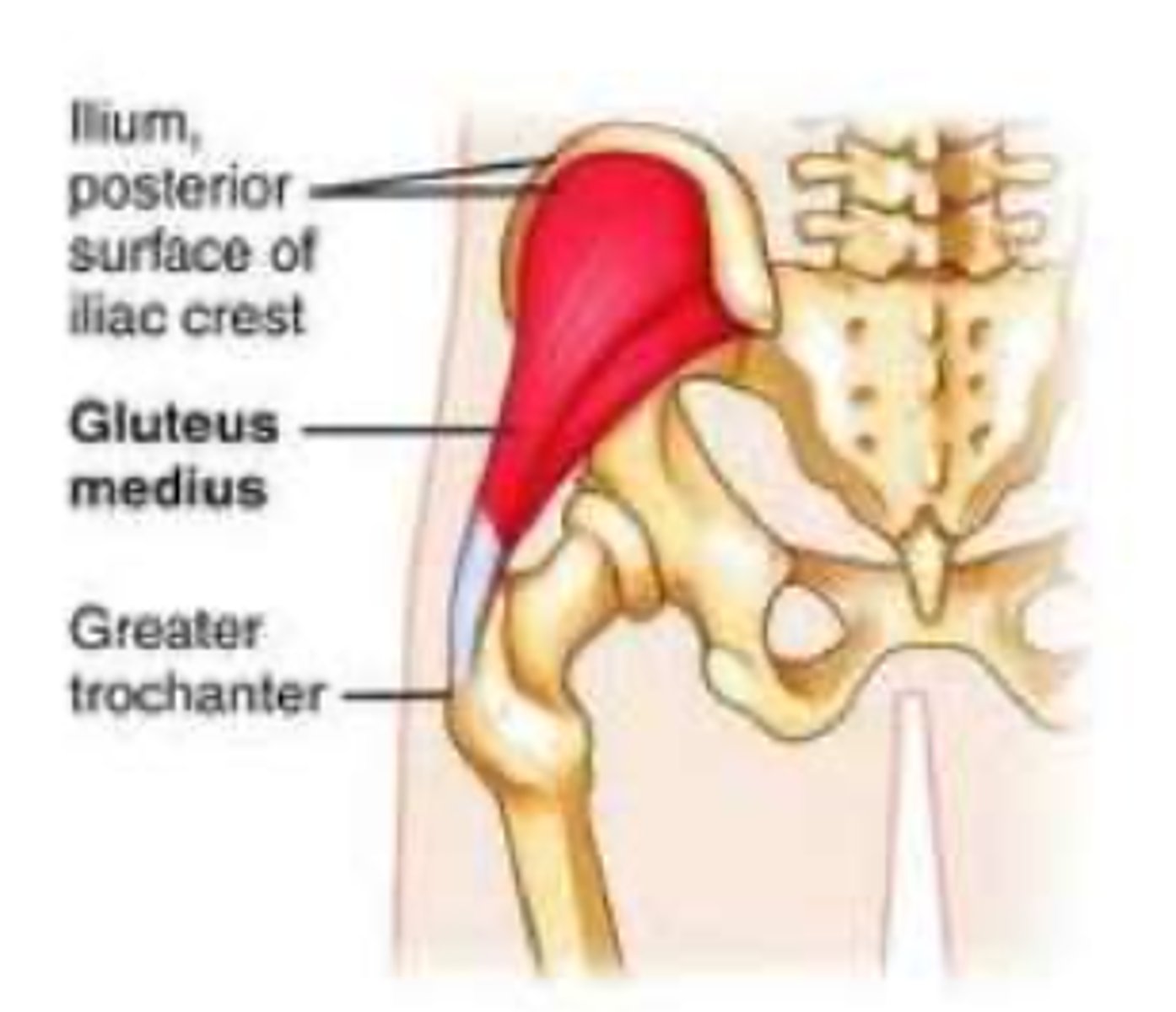 <p>non-inflammatory degenerative condition within the tendon due to collagen overload within the tendon</p><p>*though to be due to repetitive loading</p><p>**results in pain with contraction of the gluteal muscles or with passive stretching</p>