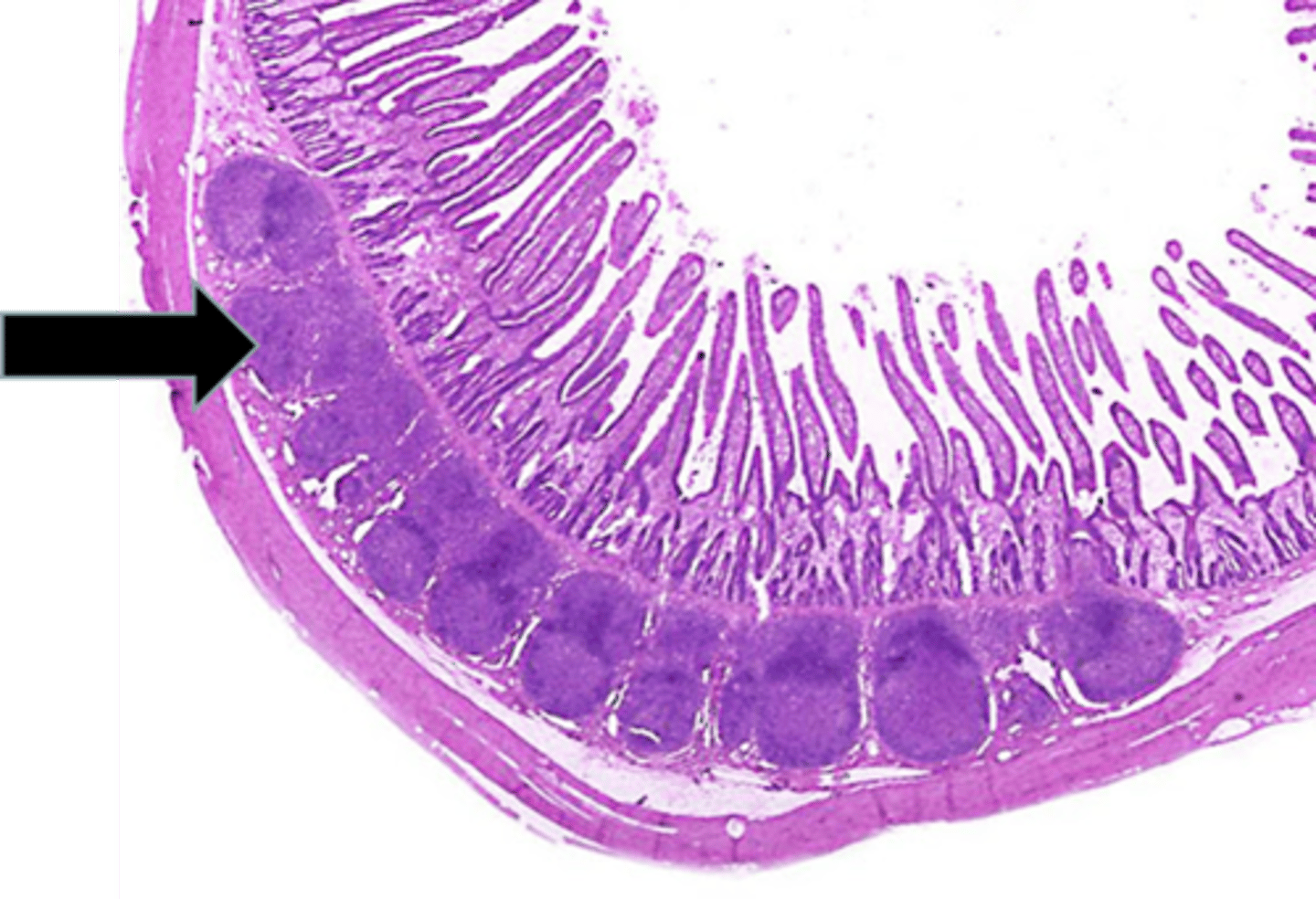 <p>black arrow</p><p>Peyer's patches</p>