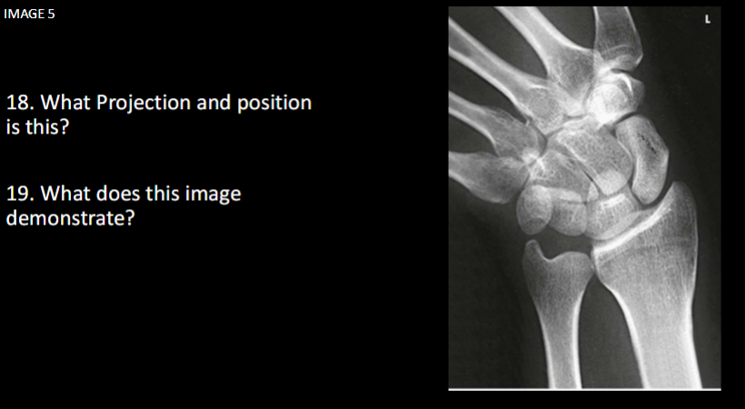 <p>What does this image demonstrate</p>