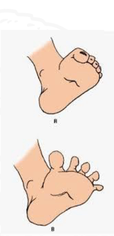 <p>Starting position </p>