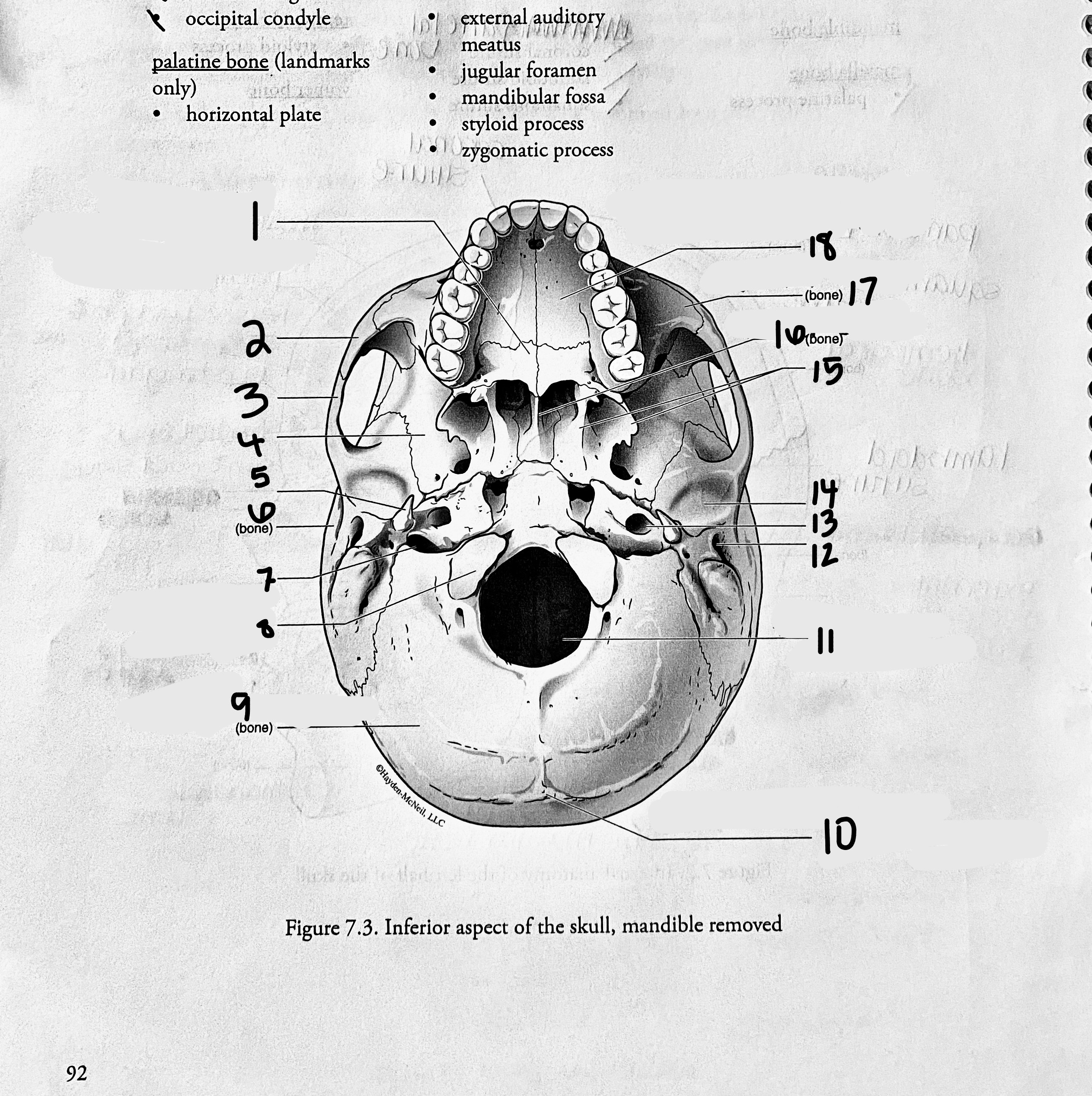 <p>Palatine Process of the Maxilla Bone</p>