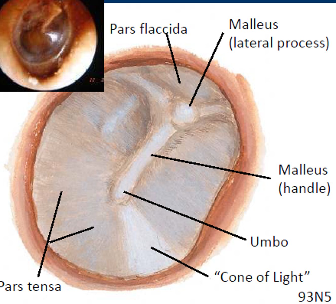<p>small, flaccid, superior section of tympanic membrane, separated from the pars tensa by the malleolar folds.</p>