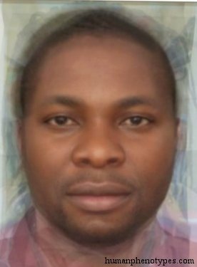<p>Identify this Phenotype</p>