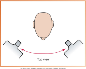<p>Positioning the PID side-to-side, directed through the contact areas.</p>