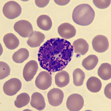 <p>What is this leukocyte?</p>