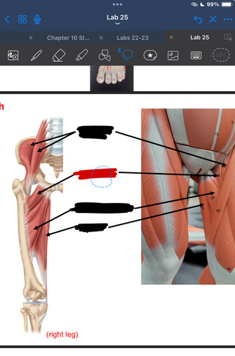 <p>What muscle is this?</p>