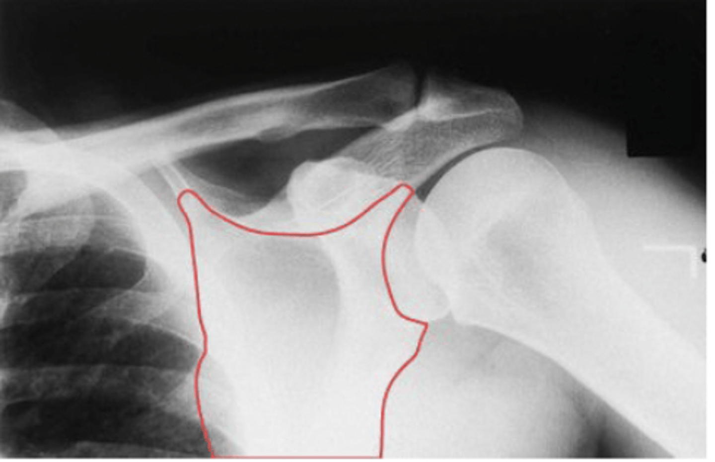 <p>What structure is highlighted?</p>