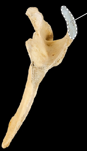 <p>Scapula, medial view, right side</p>