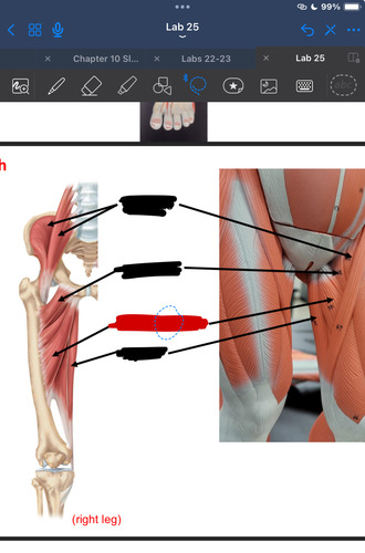 <p>What muscle is this?</p>