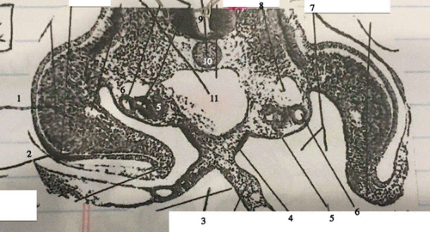 <p>the midgut (3) is compleatly ___________</p>