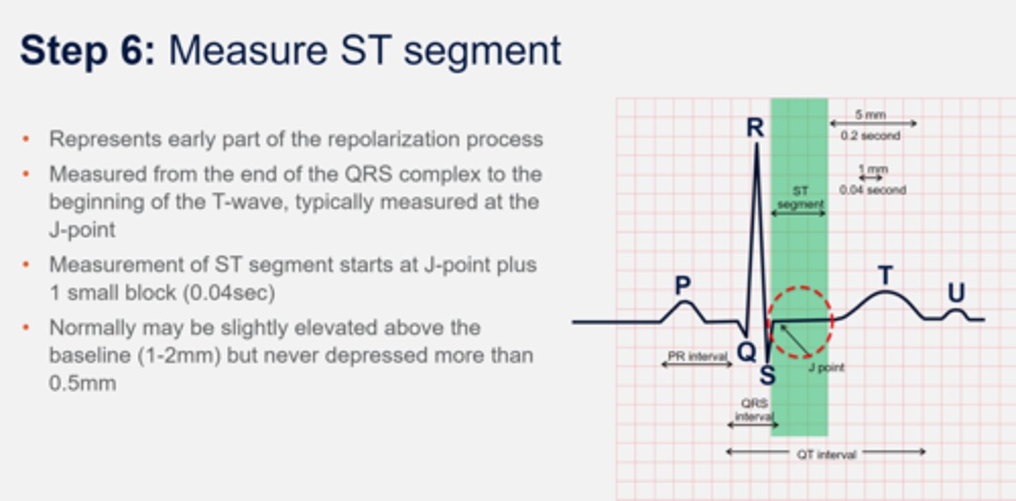 <p>Early stage of repolarization</p><p>Measured J point to beginning of T wave</p><p>Usually 0.04 seconds (one small box)</p>