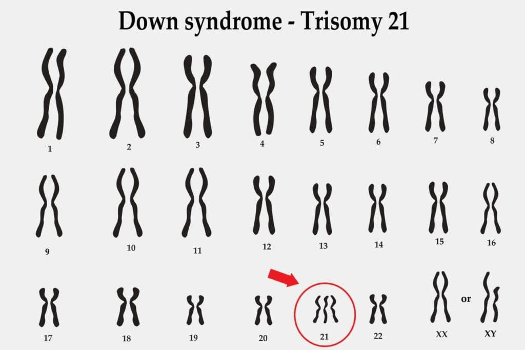 <p>Most trisomies are fatal, except if on chromosome ___. That person will have _____ ______.</p>