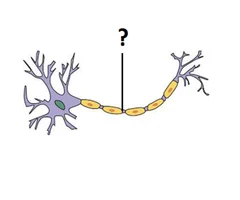 <p>Long process emanating from cell body</p><ul><li><p>Makes contact with other neurons, muscle cells, or glands</p></li></ul>