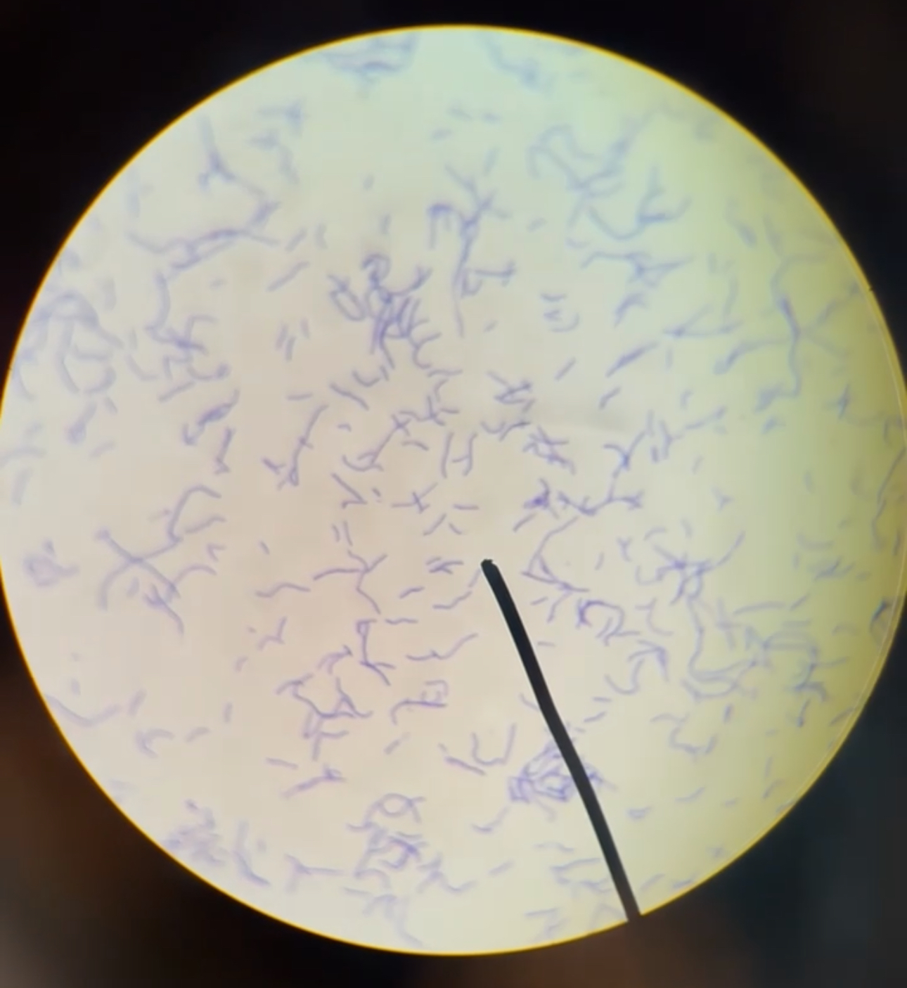 <p>What shape is this bacteria?</p>