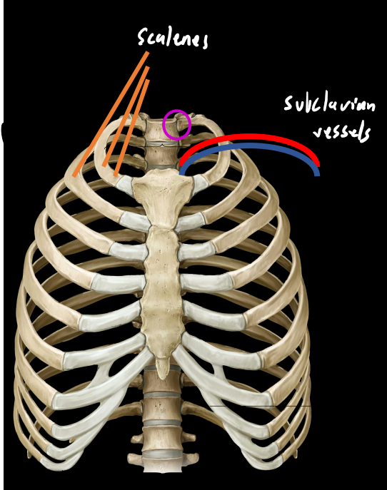 <p><strong><u>ribs 1&amp;2:</u></strong></p><ul><li><p>shorter/wider than most ribs</p></li><li><p>head of rib 1 only attaches to body of 1 vertebrae (T1)</p></li></ul><p><strong>marked by grooves:</strong></p><ul><li><p>subclavian vessels (rib 1)</p></li><li><p>scalenes (rib 1&amp;2)</p></li></ul><p></p>