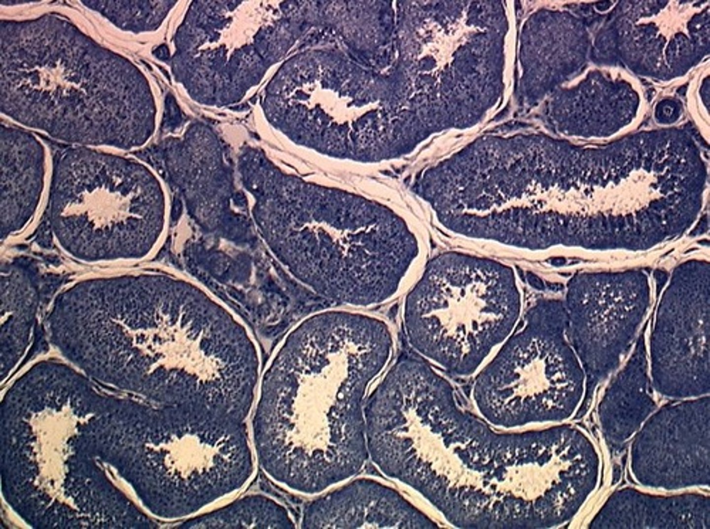 <p>Site of sperm production within the testis.</p>