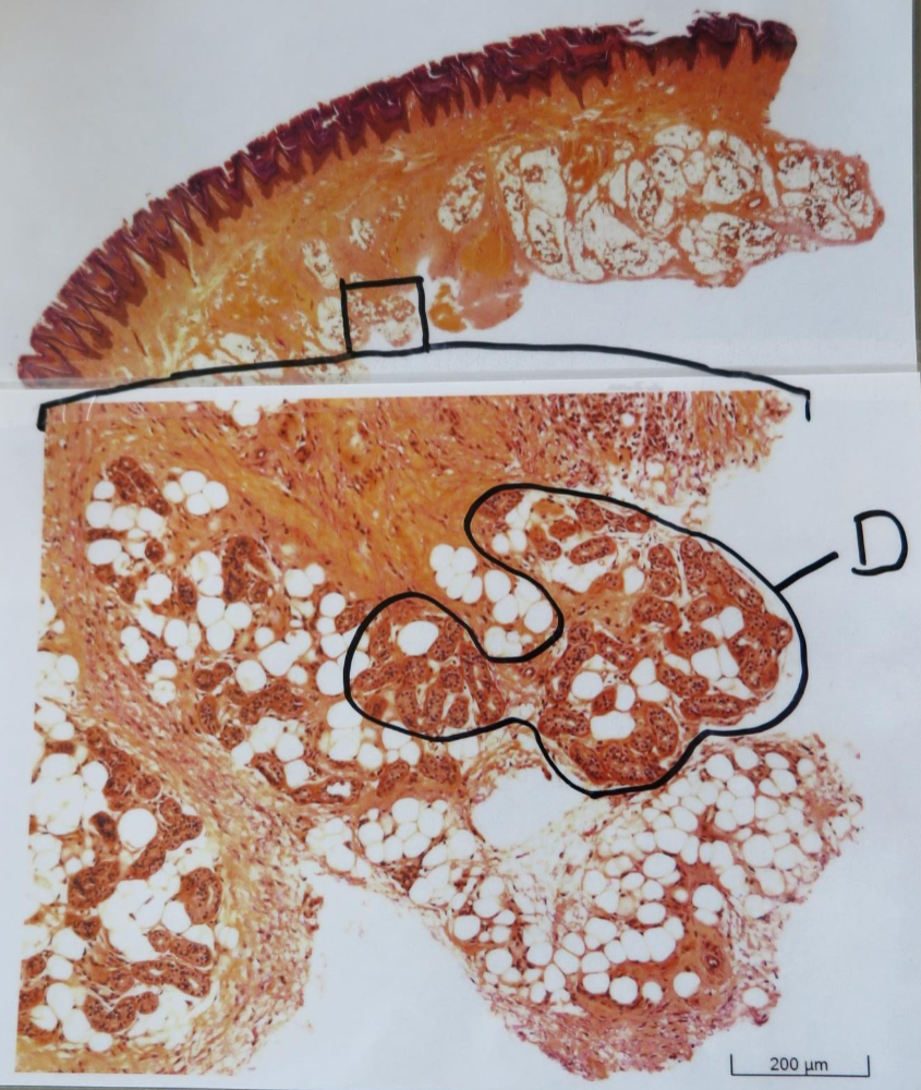 <p><strong>Post 4.</strong> <strong><em>Spot.</em></strong></p><p><u>Hudmodifikationer.</u></p><p></p><p><strong>Spørgsmål 5:</strong> Benævn og beskriv den histologiske struktur markeret med D med få ord. Se planche.</p>