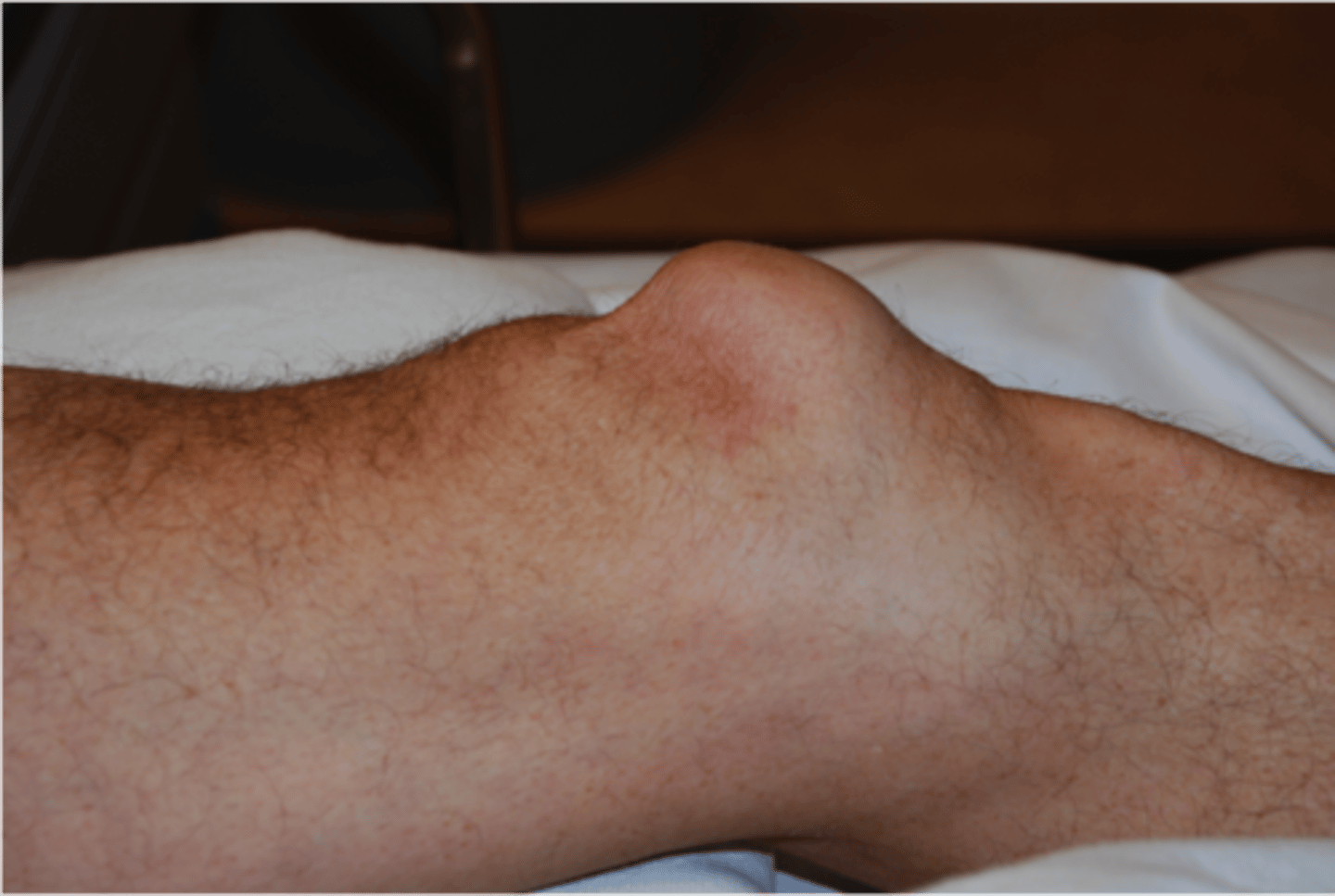 <p>what is the likley diagnosis</p>