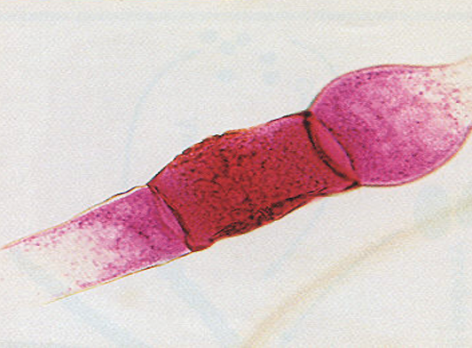 <p>is this used for sexual or asexual reproduction</p>