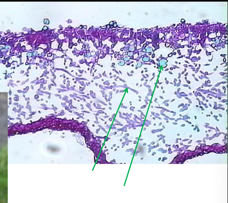 <p>Figure 6 (ascomycota)</p>