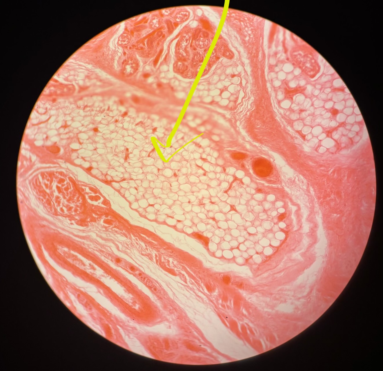 term image