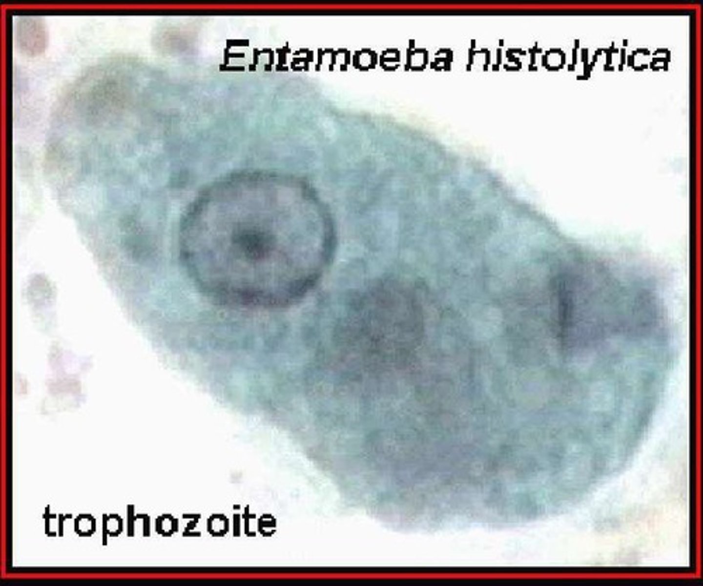 <p>Causes intestinal amoebiasis; identified in 1903.</p>