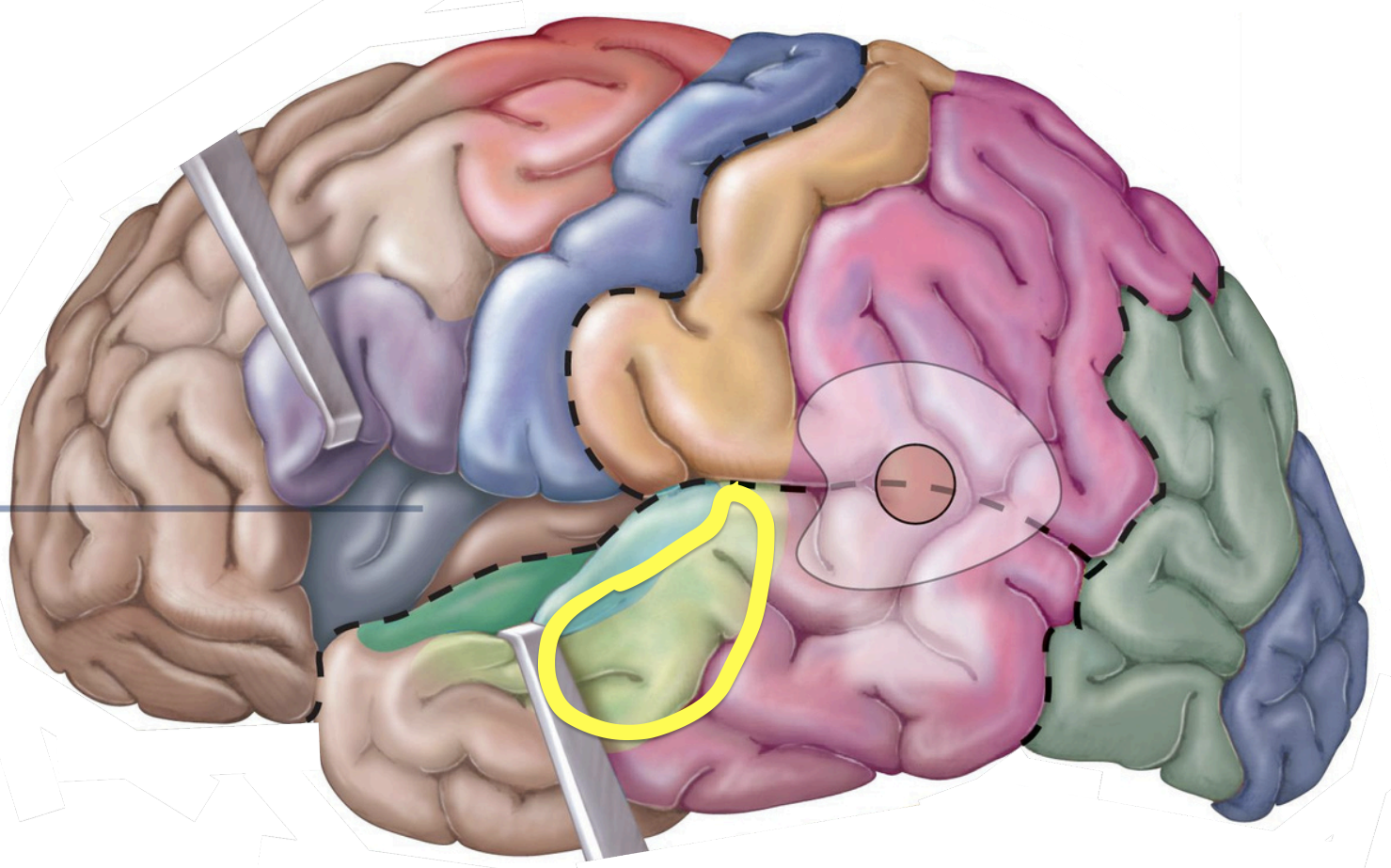 <p>Association areas - <strong>Auditory association area</strong></p>
