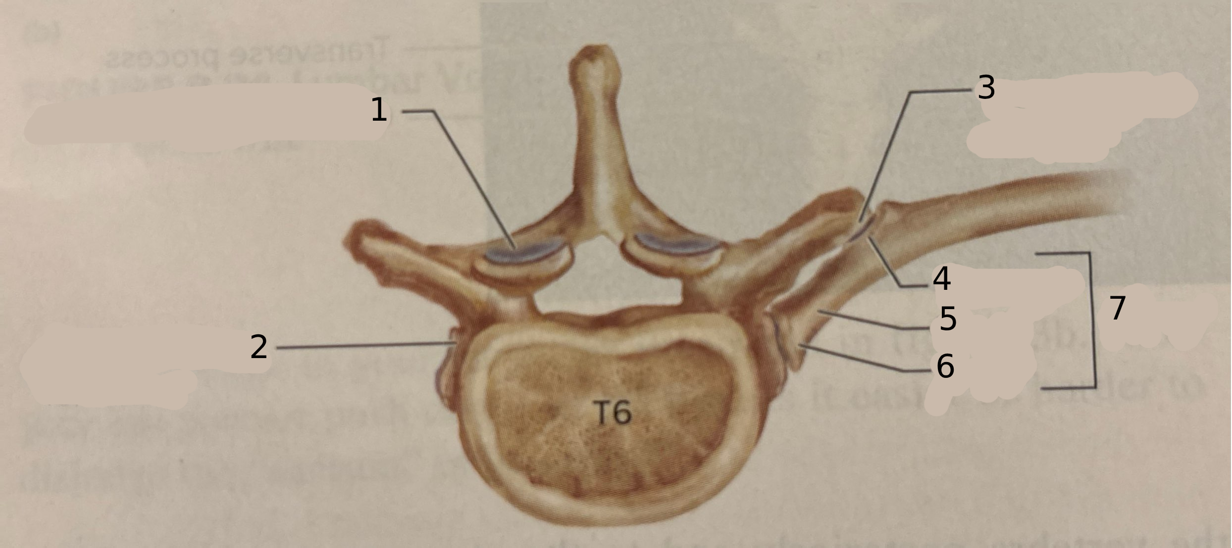<p>#2</p>