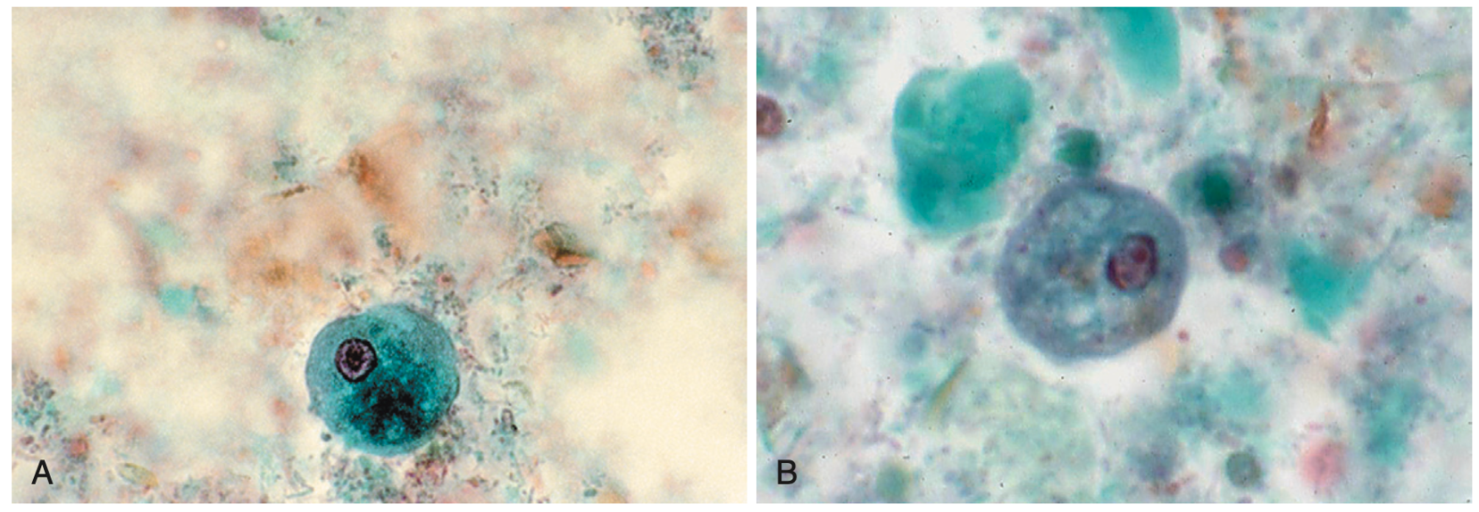 <p>A non-pathogenic ameba found in the human intestine.</p>