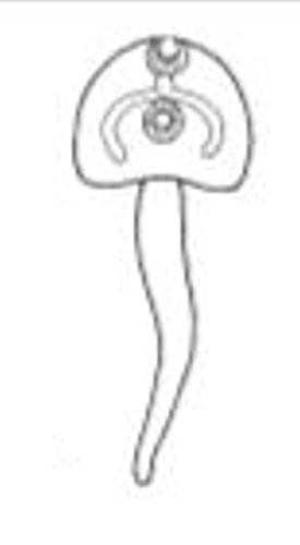 <p>Identify the type of Cercaria based on its Tail</p>