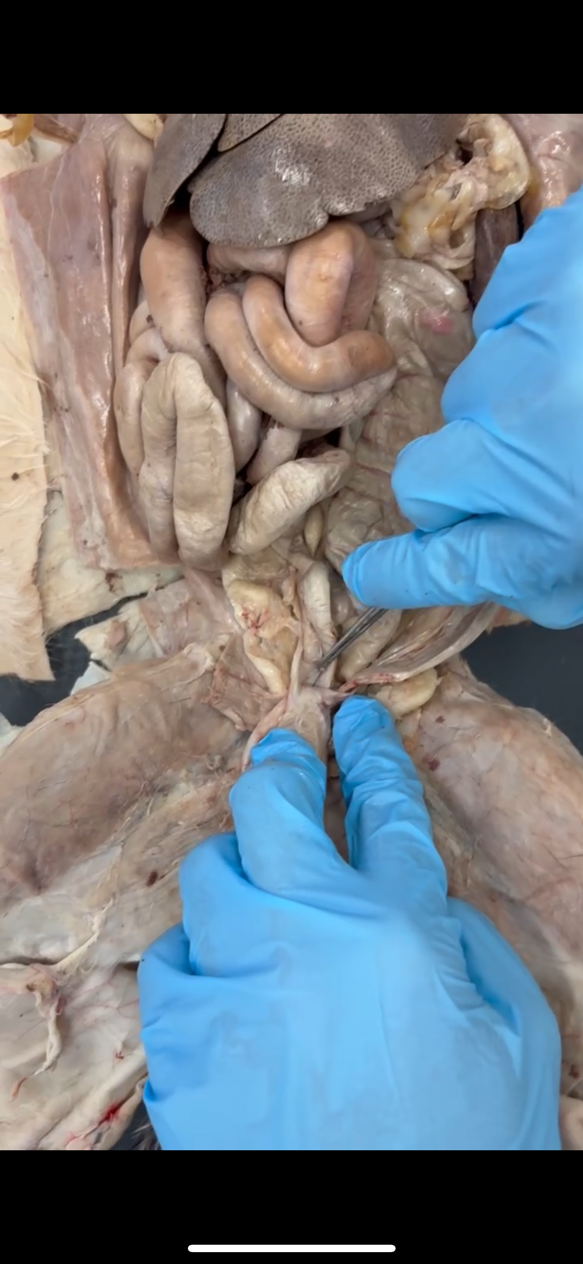 <p>Under the bladder</p>