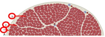 <p>(3) thin connective tissue that surrounds each myofiber</p>
