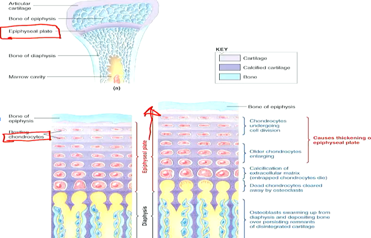 GH (largely through IGF-1) promotes bone growth through

→ Promoting increase of chondrocytes (cartilage forming cells)

→ Stimulating activity of osteoblasts (bone building cells)

\
Under stimulation of GH, bones grow in length at the epiphyseal plate through adolescence

\
At end of adolescence, epiphyseal plates close (plate filled with bone) so that bones cannot lengthen